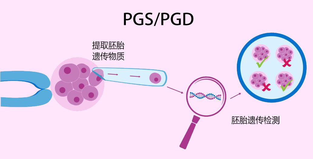 去慈铭博鳌做三代试管怎么提高成功率